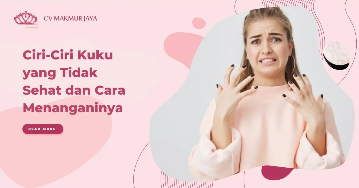 Ciri-Ciri Kuku yang Tidak Sehat dan Cara Menanganinya Ciri-Ciri Kuku yang Tidak Sehat dan Cara Menanganinya