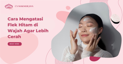 Cara Mengatasi Flek Hitam di Wajah Agar Lebih Cerah
